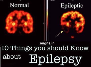 صرع چيست ؟ epilepsy