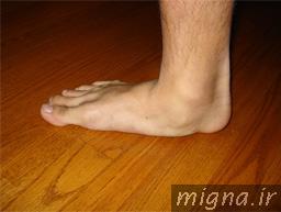صافي کف پا چیست؟!