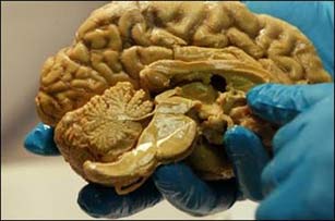 پاسخ دانشمندان به پرسش مغز بزرگ انسان و افزایش توانایی ها