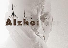 تشخیص زودهنگام آلزایمر با آزمایش خون