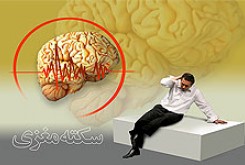 سالانه چند ایرانی‌ سکته‌ مغزی‌ می‌کنند؟ زمان طلايي نجات فرد