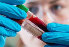 توانایی تشخیص پنج نوع سرطان با يك یک آزمایش خون ساده !