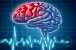 علائم و راهکارهای درمان سکته مغزی