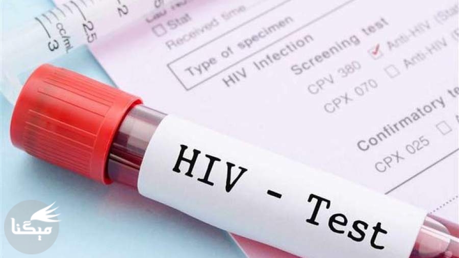 چه کسانی باید تست تشخیص ایدز دهند؟