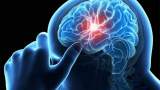 علائم اولیه سكته مغزی چیست؟