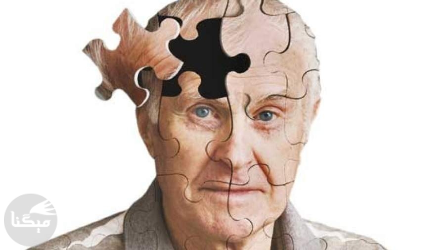 کلسترول بد سن ابتلا به آلزایمر را کاهش می دهد