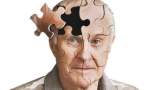 کلسترول بد سن ابتلا به آلزایمر را کاهش می دهد