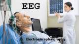 نقش دستگاه EEG در تشخیص اختلالات روانی