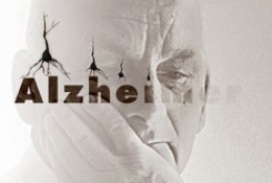 تشدید مشکلات بیماران آلزایمری با بی‌خوابی