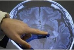 موفقیت محققان ایرانی در درمان معتادان شیشه با تحریک مغزی
