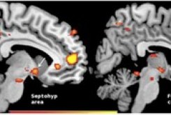 شناسایی بخش‌های مغزی مرتبط با حس همدردی