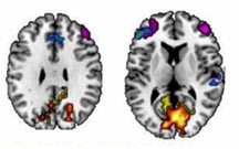 کشف تاثیر الگوهای اتصالات مغزی روی توانایی حافظه‌ افراد