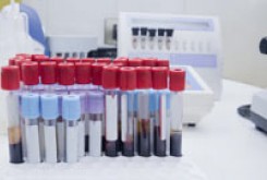 تشخیص اختلال دو قطبی با یک آزمایش خون ساده!