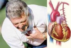حملات قلبی در چه ساعاتی بیشتر رخ می‌دهند؟