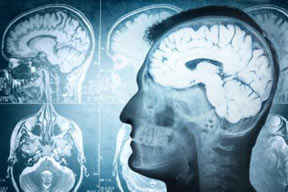 ضربات شدید به سر باعث تغییر ژن های مغز می شوند