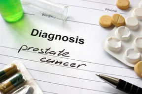 تاثیر داروهای ضدافسردگی در کاهش شیوع سرطان پروستات