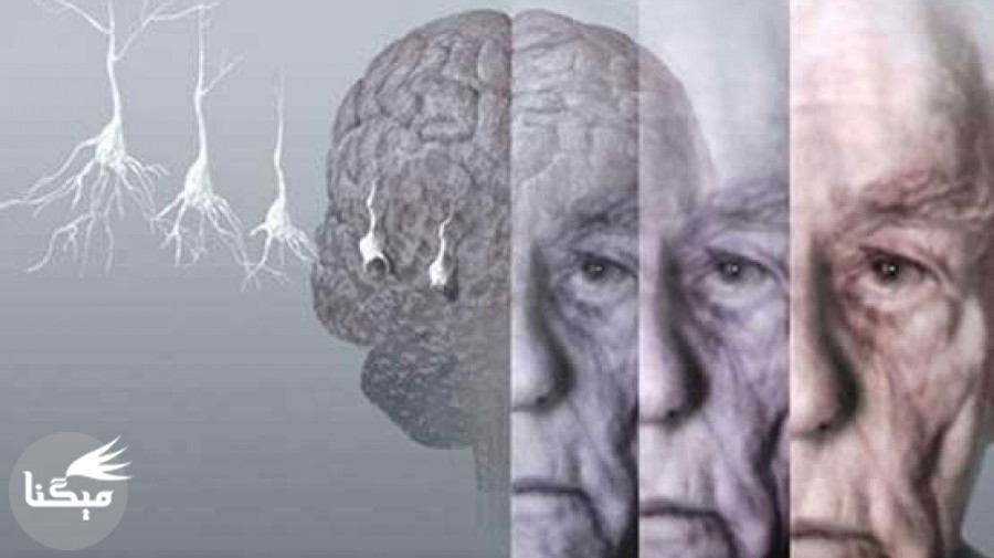 علل بروز زوال عقل/ «دمانس» در حافظه کوتاه مدت اختلال پایدار ایجاد می‌کند