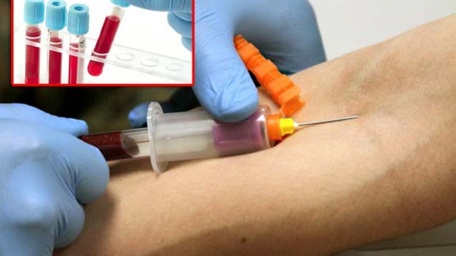 بیست سوال مهم پیرامون آزمایش خون