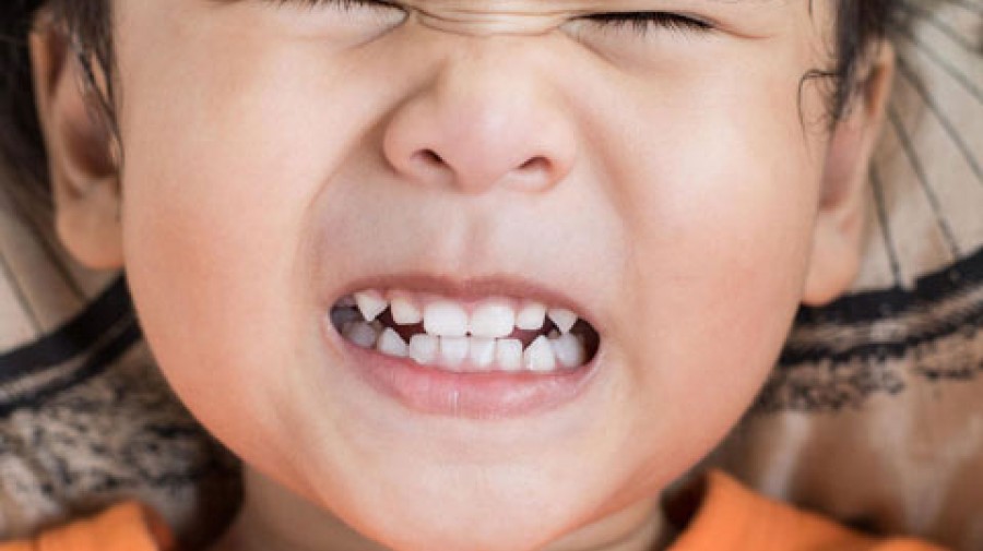 ارتباط دندان قروچه با اضطراب های طول روز