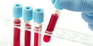 10 نکته آزمایش خون که پزشکان به شما نخواهد گفت