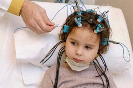 ارتباط سندروم ژنتیکی و تومور مغزی در کودکان