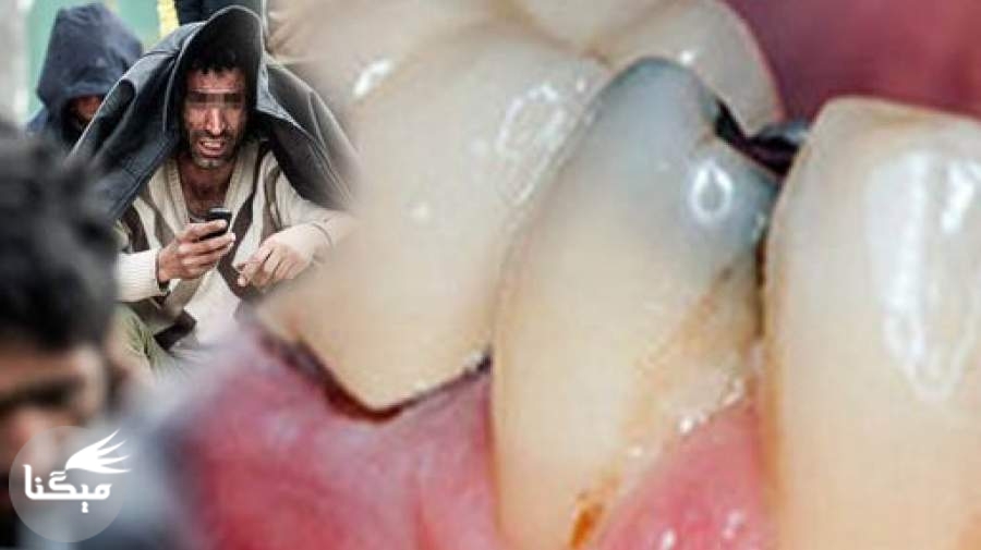 تاثیر مخدرهای سنتی و صنعتی بر دندان‌ها