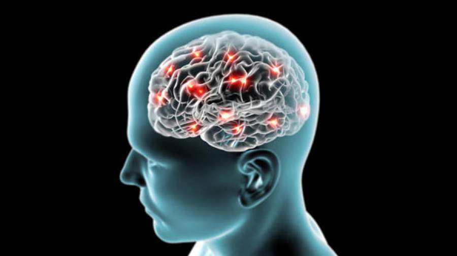 تجمع آهن در مغز باعث ابتلا به بیماری آلزایمر می‌شود