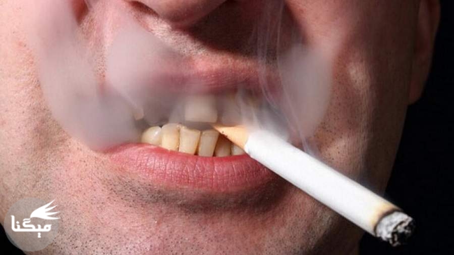 دخانیات و الکل از علل اصلی سرطان‌های دهان