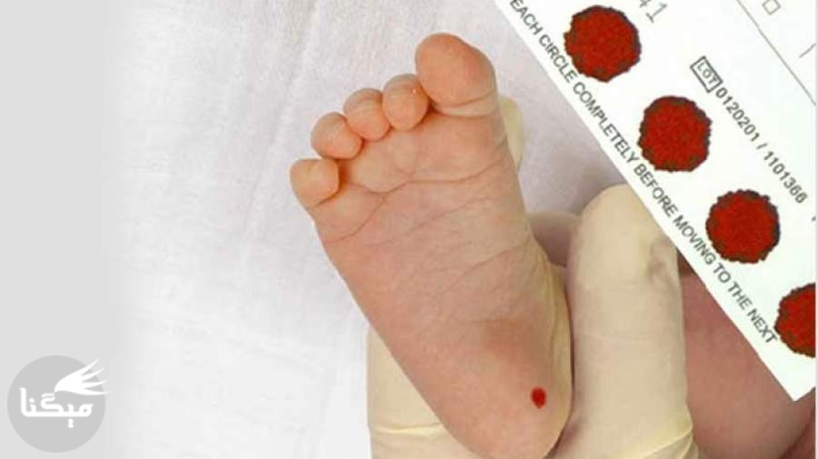 تشخیص ۵۲ نوع بیماری متابولیک با یک قطره خون نوزاد