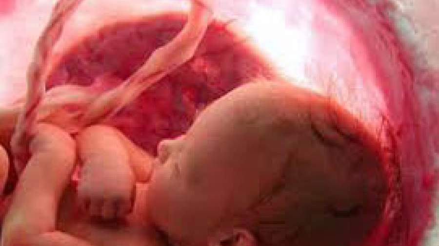 عوارض مرگبار سقط جنین برای مادران