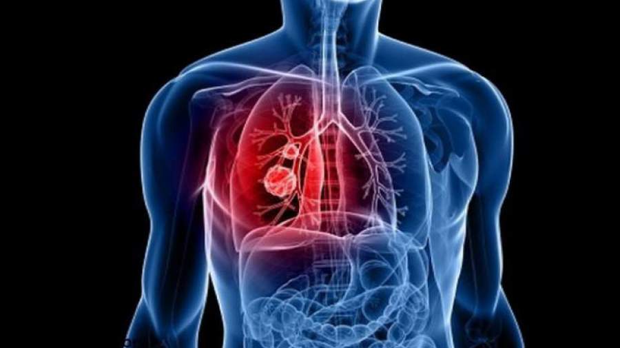 درباره سیستم تنفسی خود چه میدانید؟