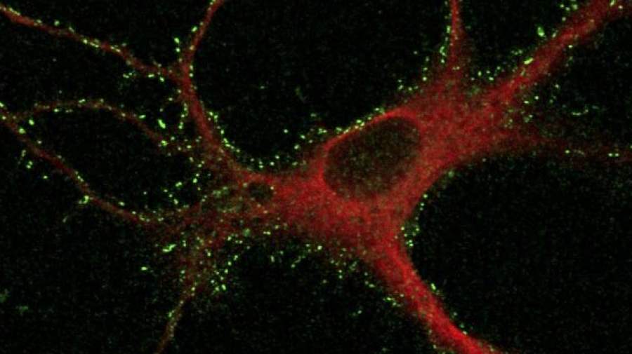 پروتئین‌هایی که اسرار حافظه و یادگیری را فاش می‌کنند