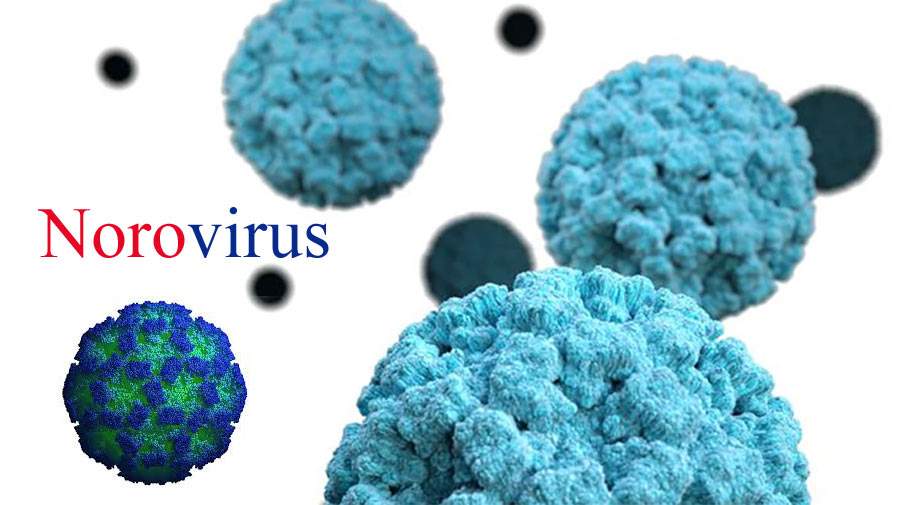 نورو ویروس (Norovirus) چیست؟