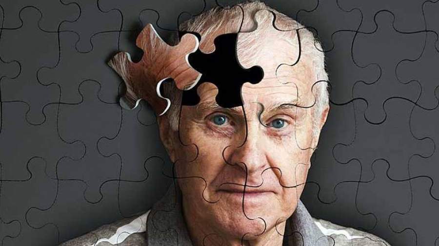 آلزایمر خیلی زودتر از آنچه فکر می‌کنیم، آغاز می‌شود