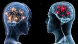مغز «مردان» از زنان بزرگتر است/استفاده بیشتر «زنان» از دو نیمکره مغز