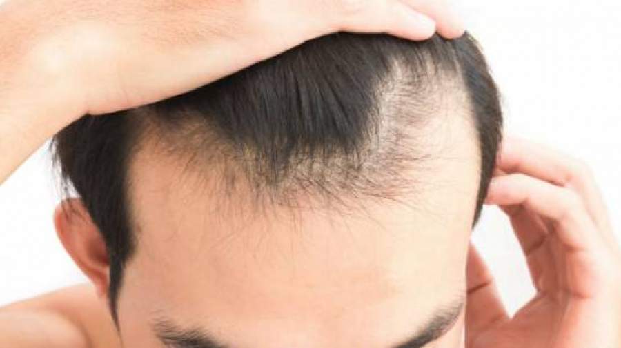 تا چه اندازه ریزش مو در یک روز طبیعی است؟
