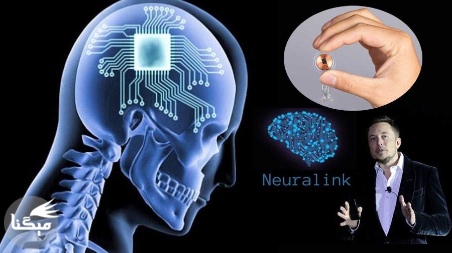 تراشه "نورالینک" کمتر از یک سال دیگر به مغز انسان می‌رسد!