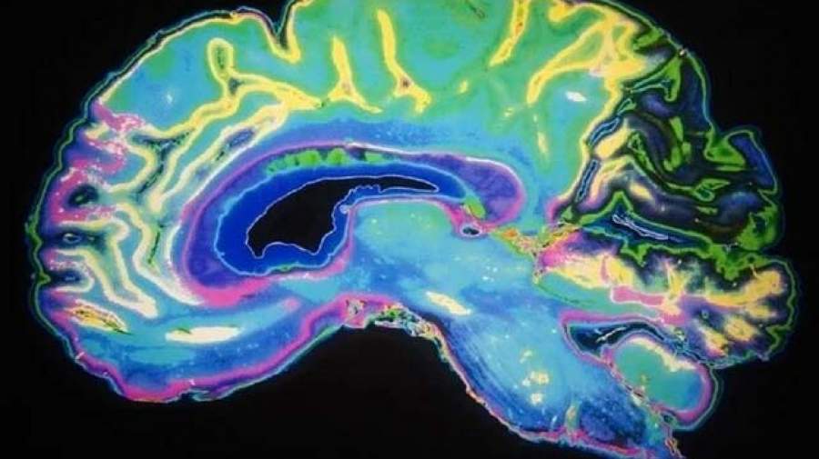 کشف مسیر انتقال ریزذرات مضر از ریه‌ها به مغز