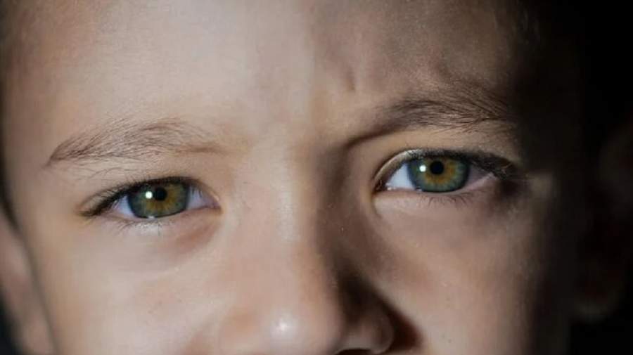 تشخیص اوتیسم در کودکان با یک آزمایش ساده چشم