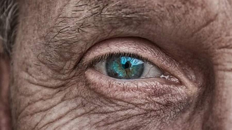 استرس مکرر باعث پیر چشمی می‌شود