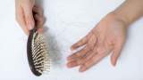 ریزش مو در زنان نشانه  چه بیماری هایی است